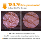 Body & Face Peel Shot Duo